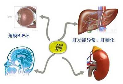 人体麻豆视频在线网站数据能够准检测出但身体中微量元素铜超标会引起疾病发生 人体麻豆视频在线网站数据能够准检测出但身体中微量元素铜超标会引起疾病发生
